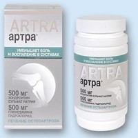 Отзыв на АРТРА® (ARTRA®) 60 таблеток